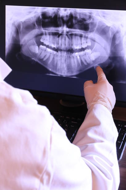 Best Emergency Dental Care for Broken or Chipped Teeth in Pine Ridge, PA